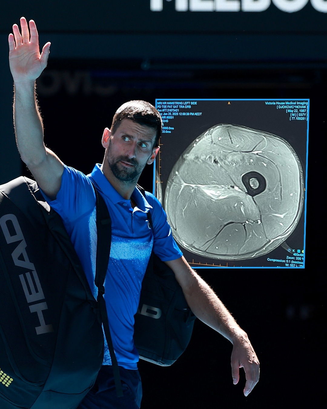 德国网球队完胜日本网球队，德约科维奇完成帽子戏法的简单介绍